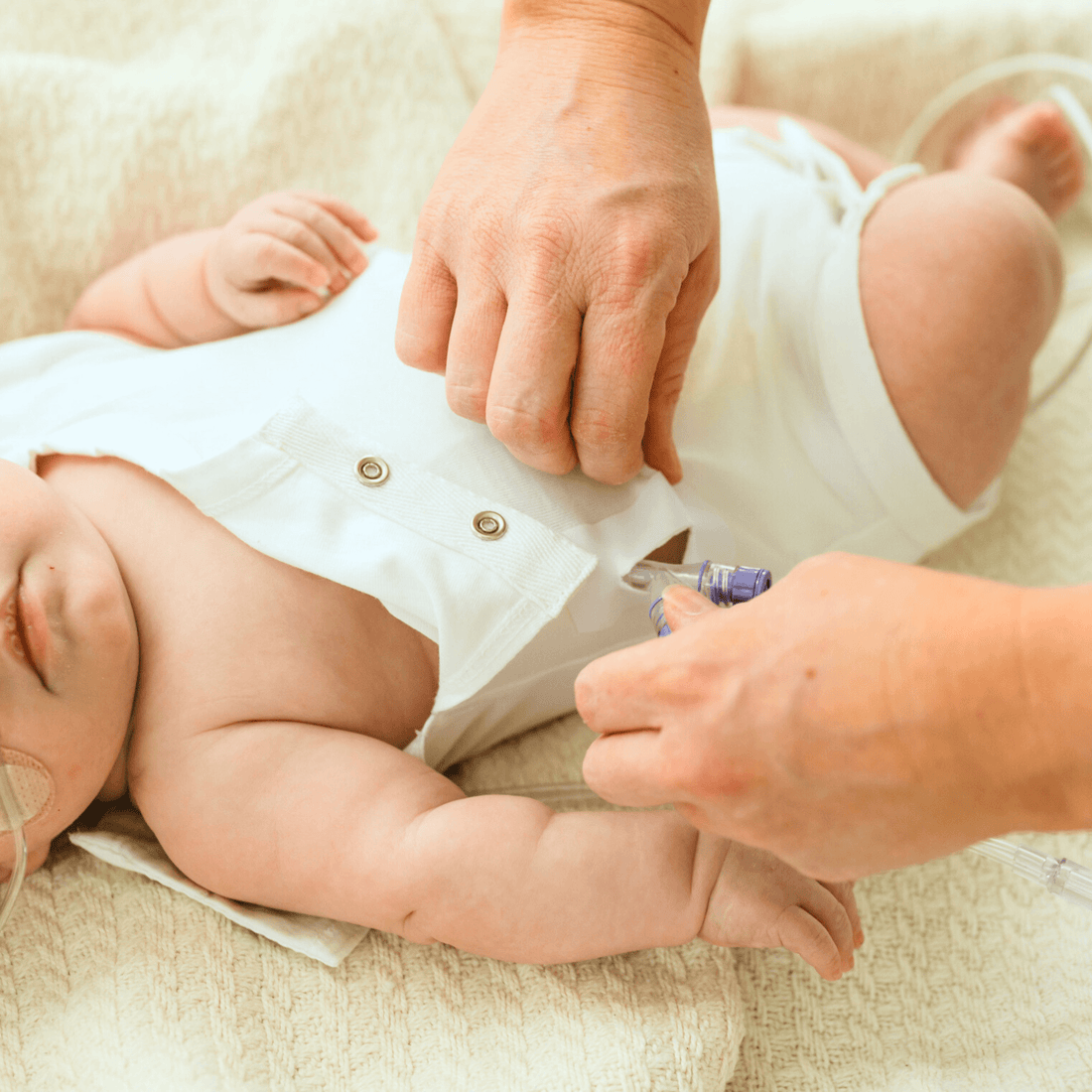 parent-using-tube-eeze-patch-to-access-babyโs-g-tube-port-on-soft-white-outfit-for-easy-feeding.