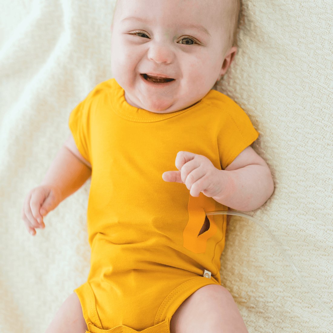 smiling-baby-wearing-a-yellow-bodysuit-with-an-easy-access-g-tube-patch-for-feeding-convenience.