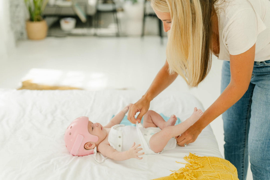 How Long Do Babies Have to Wear Helmets?